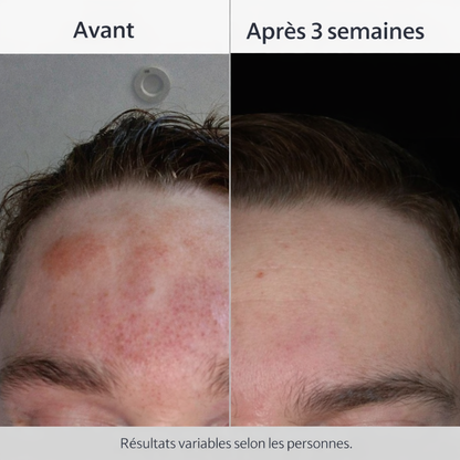 Le soin apaisant pour les peaux exigeantes