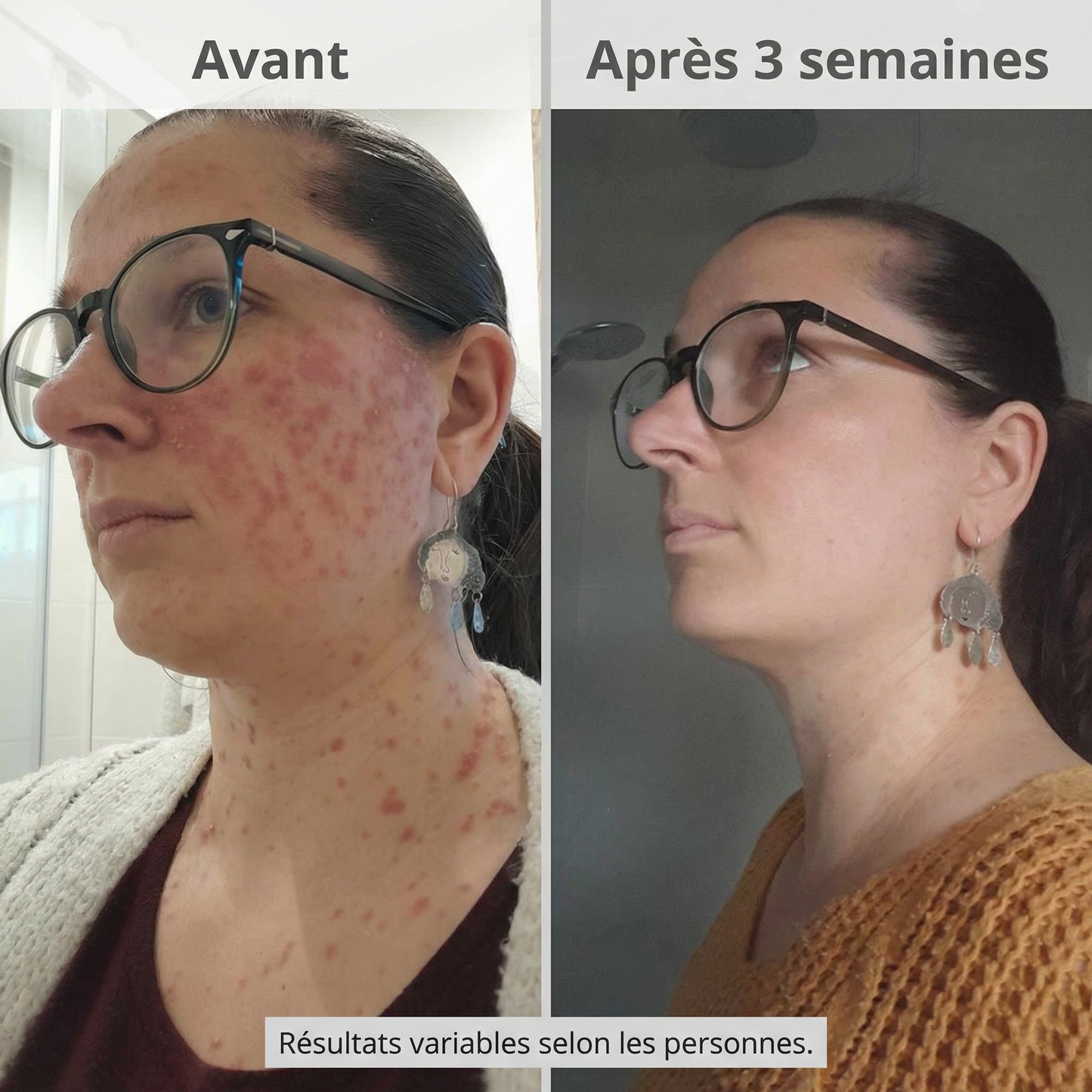 Le soin apaisant pour les peaux exigeantes